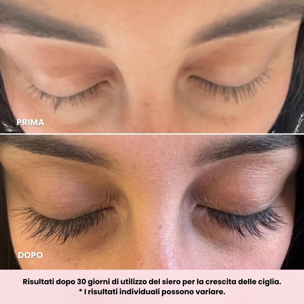 Siero per la Crescita delle Ciglia